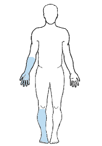 Schematische Darstellung: Regionalanästhesie