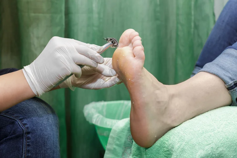 Diabetisches Fußsyndrom