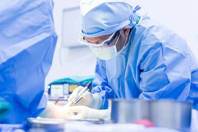 Arzt trägt sterile Fliegenmaden auf eine diabetische Fußwunde auf.
