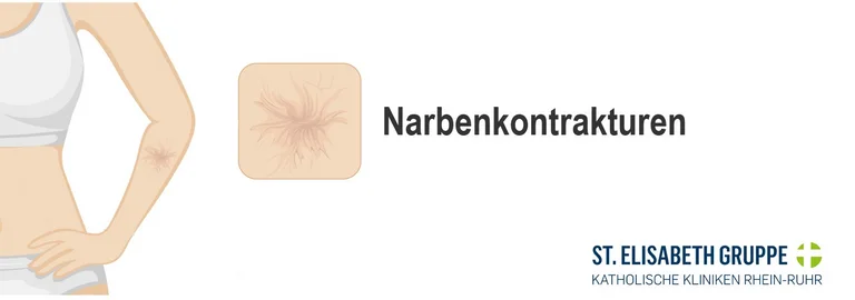 Narbenkontrakturen nach Verbrennungen - straffe Gewebebänder, die Funktion einschränken