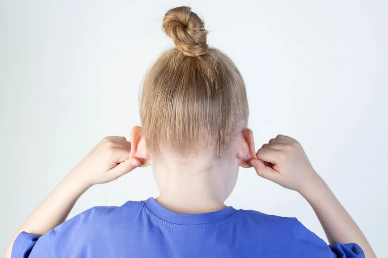 Abstehende Ohren (auch Segelohren genannt) sind meist eine angeborene, harmlose Formabweichung, die genetisch bedingt ist und oft schon bei Babys sichtbar wird, aber auch später erst auffallen kann.