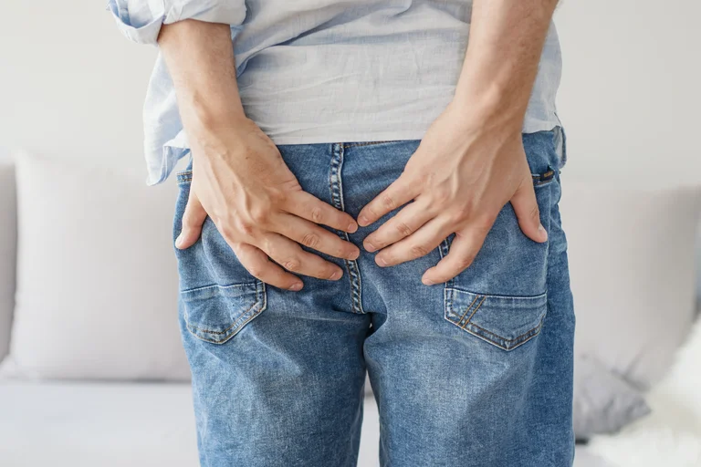 Eine Perianalvenenthrombose ist eine Schwellung am Afterrand, die durch ein oder mehrere Blutgerinnsel (Thrombose) ausgelöst werden.