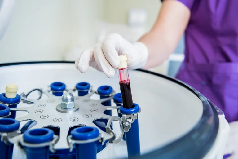 Eigenbluttherapie: Die verschiedenen Bestandteile des Blutes