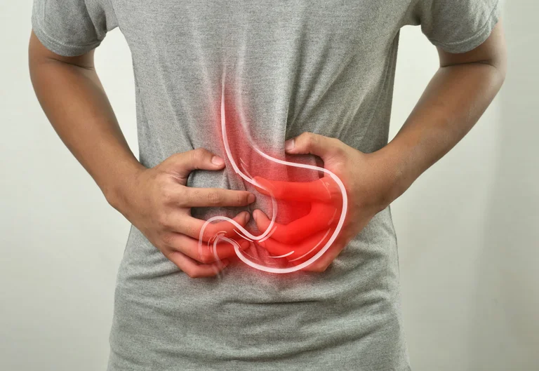 Patienten mit einem Magengeschwür leiden meist unter Schmerzen im Oberbauch, Appetitlosigkeit, Übelkeit und Erbrechen.