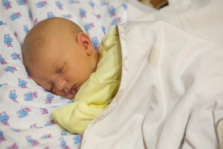 Schlafendes Baby mit Gelbsucht.