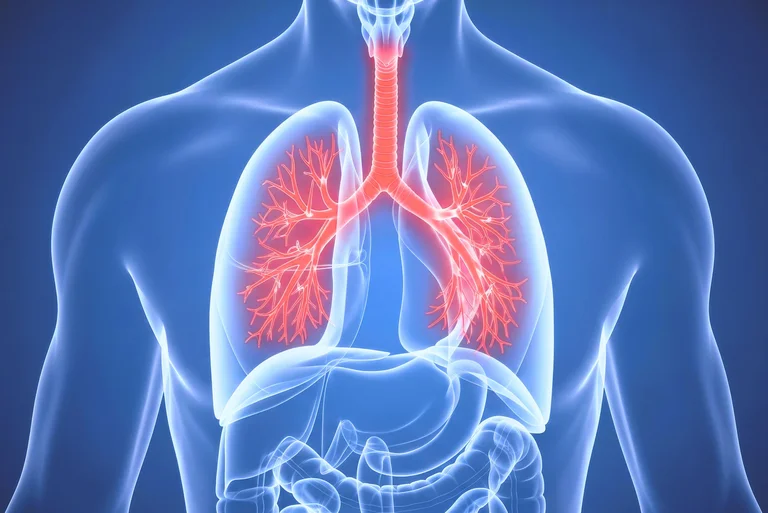 Eine Rippenfellentzündung tritt oft als Folge einer Lungenentzündung oder einer akuten Bronchitis auf.