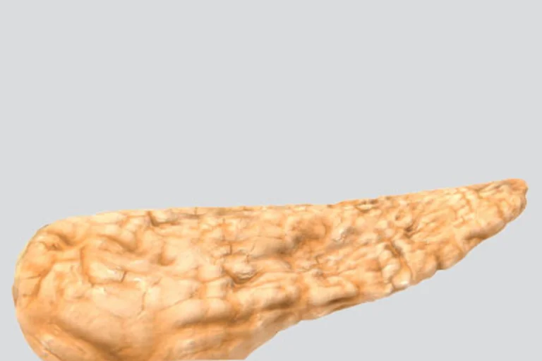 Abgebildet ist eine Bauchspeicheldrüse. Pankreas divisum gehört zu den häufigsten anatomischen Veränderungen der Bauchspeicheldrüse.