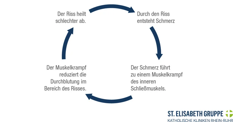 Darstellung des Teufelskreises einer Analfissur, die nicht heilt.