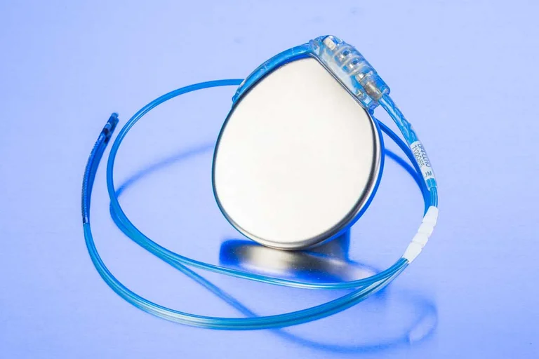 Bei Herzrhythmusstörungen wird ein Defibrillator eingesetzt, wenn Patienten ein erhöhtes Risiko für Kammerflimmern aufweisen.  