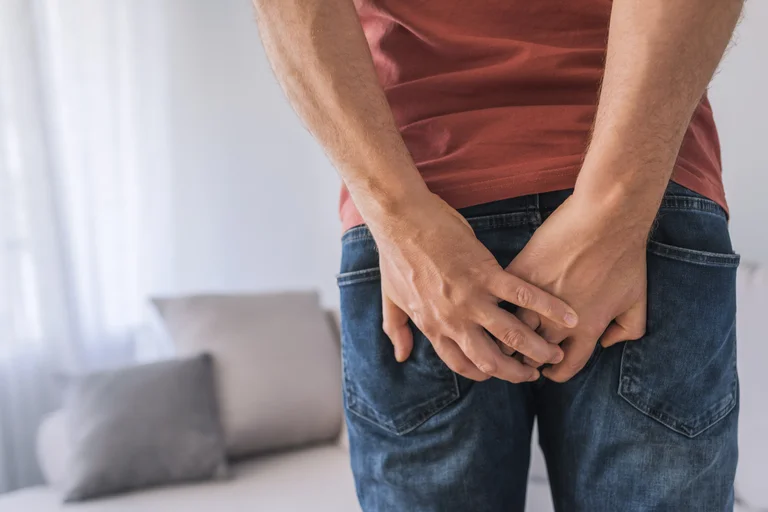 Ein Analabszess bezeichnet eine Entzündung der Proktodealdrüsen an der Schleimhaut des Afters.