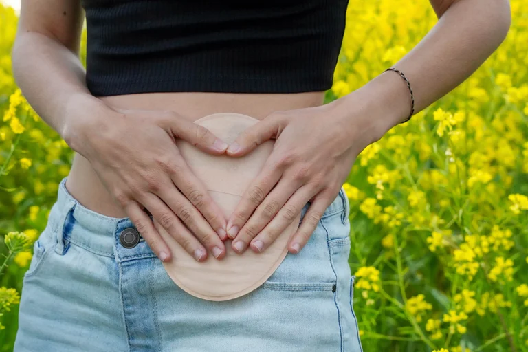 Die GHD GesundHeits GmbH Deutschland unterstützt Patienten mit Stoma nach dem Krankenhausaufenthalt bei der weiteren Versorgung zu Hause.