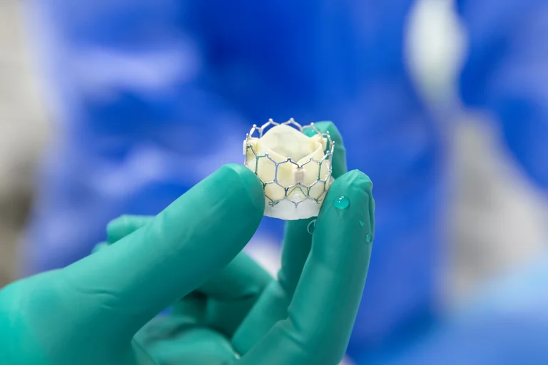 Bei der minimal-invasiven Operationsmethode der Aortenklappenstenose kommt das TAVI-Verfahren (Transfemoraler kathetergestützter Aortenklappenersatz) zum Einsatz.
