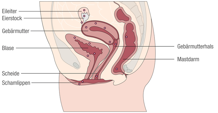 Infografik, die einen weiblichen Unterkörper zeigt. Zu sehen sind die inneren Organe mit kleinen Punkten, die Endometriosegwebe darstellen.