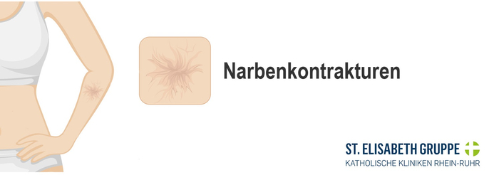 Narbenkontrakturen nach Verbrennungen - straffe Gewebebänder, die Funktion einschränken