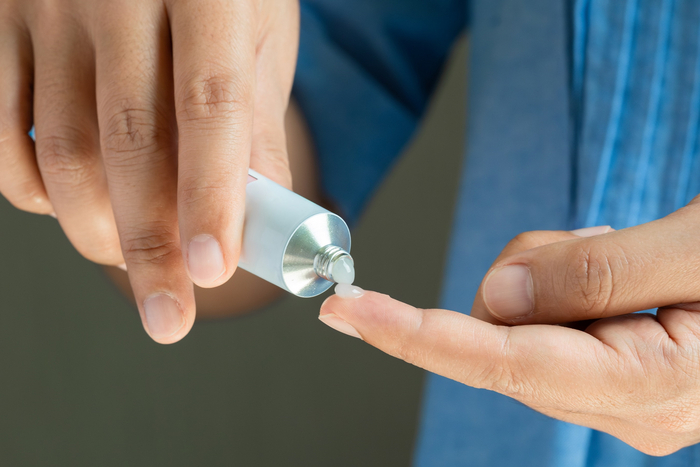 Darstellung einer Salbe, die bei der Behandlung einer Analfissur zum Einsatz kommen kann.