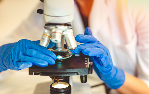 Bei der feingeweblichen Untersuchung wird das Tumorgewebe unter dem Mikroskop untersucht.