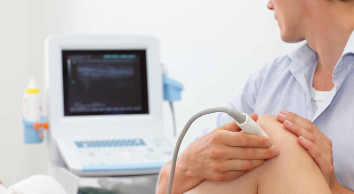 Ultraschalluntersuchung der Beinarterien zur Diagnose eines peripheren Aneurysmas