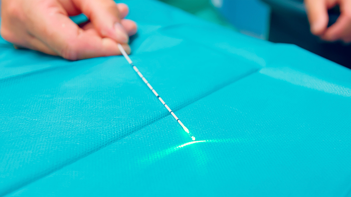 Der Laser kommt bei der Behandlung einer chronischen Analfissur zum Einsatz.