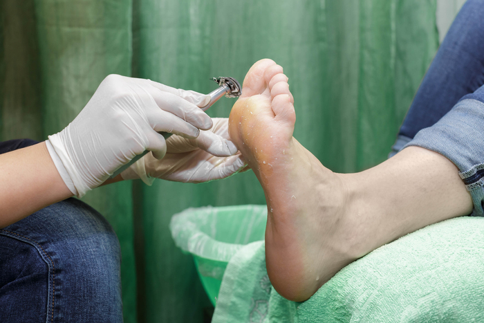 Fußpflege zur Vorbeugung des diabetischen Fußsyndroms