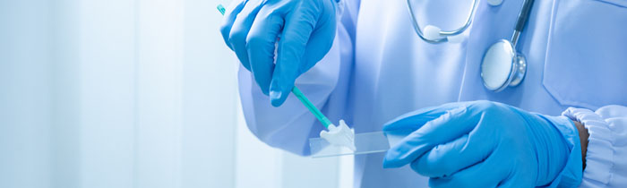 Scheidenkrebs oder Vaginalkarzinom ist eine bösartige gynökologische Krebserkrankung