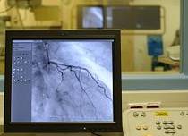 Herzkatheter Kardiologie Ballondilatation Stent