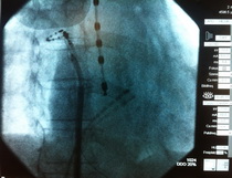 Marien_Hospital_Witten_Bergbauer_PVI-Roe_01.JPG